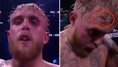 Fight – L’impressionnante blessure de Jake Paul en plein combat ! (vidéo)